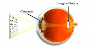 cataracta-300x159
